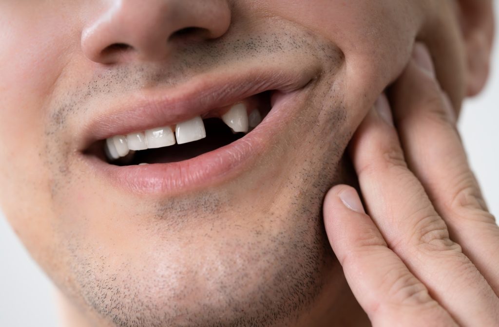 Man with a knocked-out tooth holding his cheek in pain