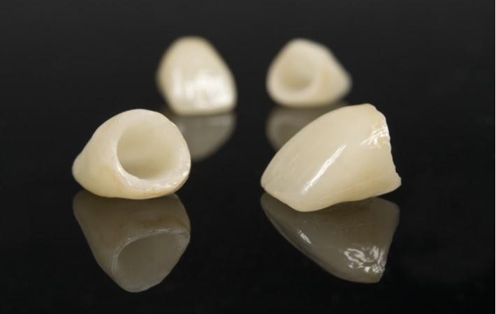 Four old dental crowns laying on a black surface