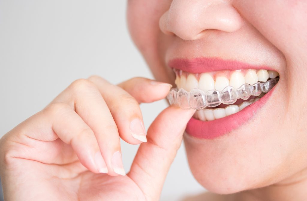 A close up of a woman putting in her Invisalign to straighten her teeth