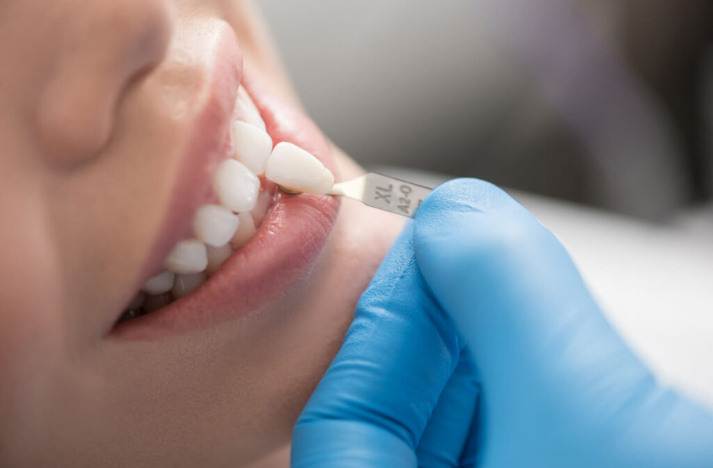 A close-up of a dentist matching a dental crown color on a patient's teeth.