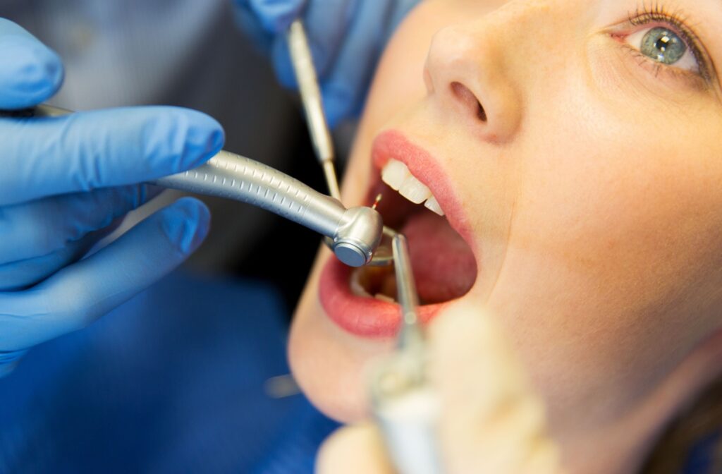 A close up of a dental patient having a cavity filled with a dentist holding a dental drill.