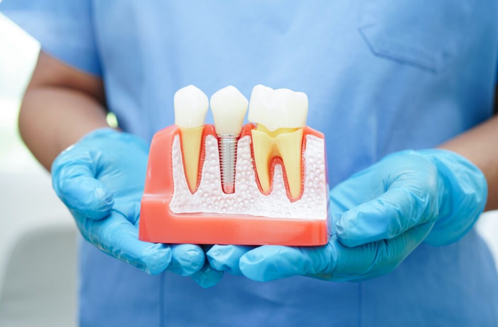 A dentist holding up a model that shows how a dental implant fits into the inside of the gums and jaw bone.