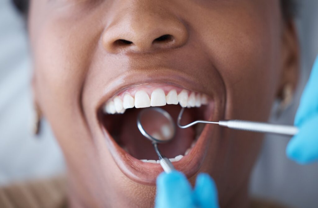 Patient receiving a professional teeth cleaning during a routine dental exam