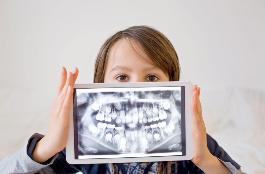 A preteen boy displays a tablet showing an X-ray image of his permanent teeth beneath his baby teeth.