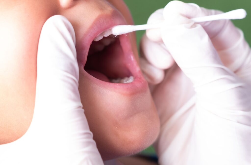A dentist applies fluoride varnish to a child's teeth to prevent tooth decay.