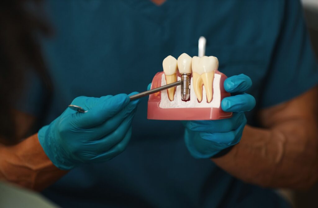A dentist pointing to a model of a dental implant, showing the patient the titanium root.